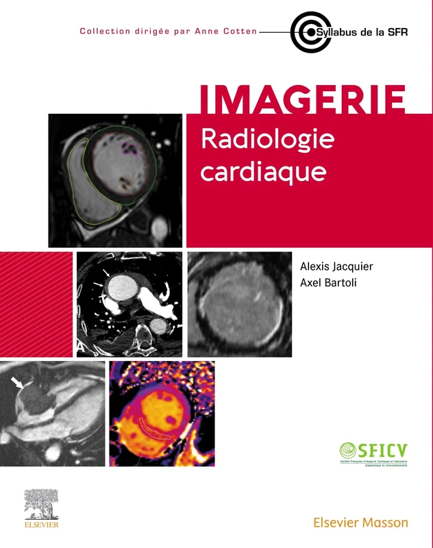 Radiologie cardiaque