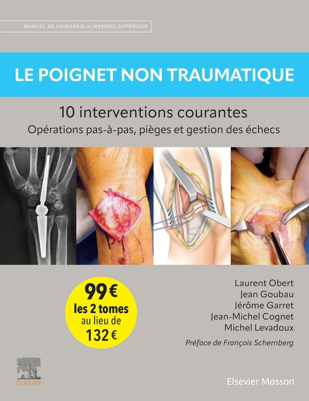 Pack Le poignet traumatique / Le poignet non traumatique - 10 interventions courantes - tomes: Manuel de chirurgie du membre supérieur - Image 1