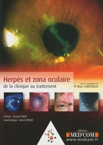 HERPES ET ZONA OCULAIRE (0000): De la clinique au traitement