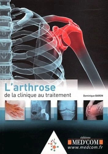 L'ARTHROSE : DE LA CLINIQUE AU TRAITEMENT (0000)