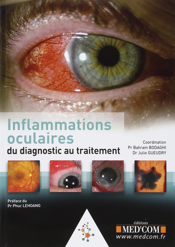 L'INFLAMMATION OCULAIRE -DE LA CLINIQUE AU TRAITEMENT (0000)