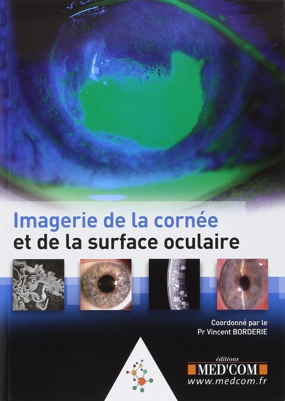 IMAGERIE DE LA CORNEE ET DE LA SURFACE OCULAIRE (0000)