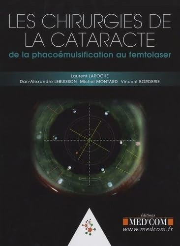 LES CHIRURGIE DE LA CATARACTE. DE LA PHACOEMULSIFICATION AU FEMTOLASER: De la phacoémulsification au femtolaser