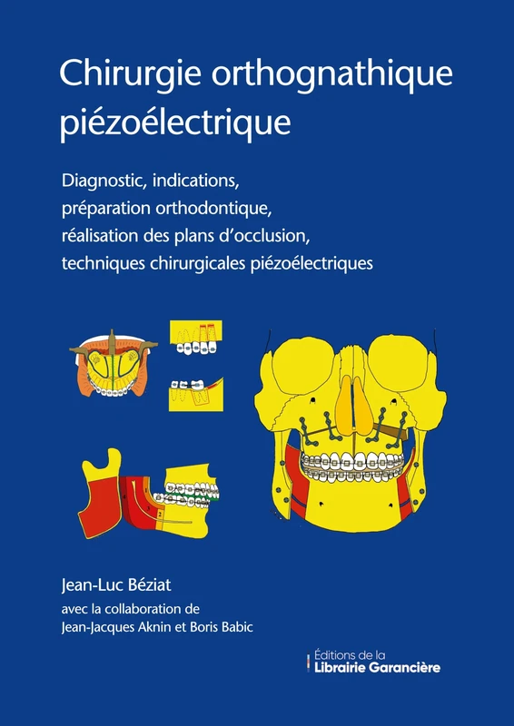 Chirurgie orthognathique piézoélectrique: Diagnostic, indications, préparation orthodontique, réalisation des plans d'occlusion, techniques chirurgicales piézoélectriques
