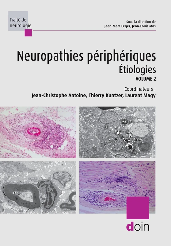 Neuropathies périphériques. Volume 2 : Etiologies: Volume 2
