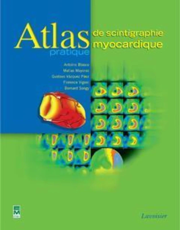 Atlas pratique de scintigraphie myocardique - TEC ET DOC