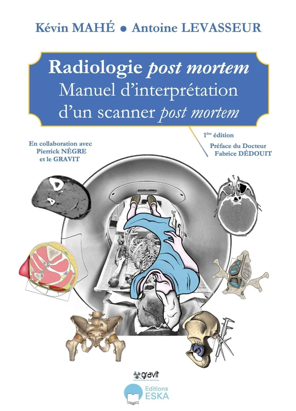 Radiologie post mortem: Manuel d'interprétation d'un scanner post mortem - Image 1
