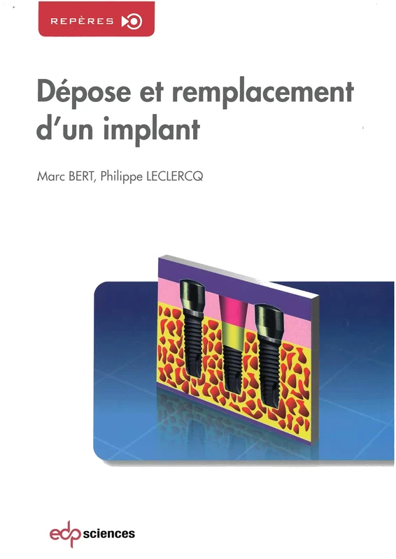 DEPOSE ET REMPLACEMENT D'UN IMPLANT: 0 - Image 1