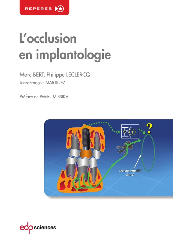 OCCLUSION EN IMPLANTOLOGIE - Image 1