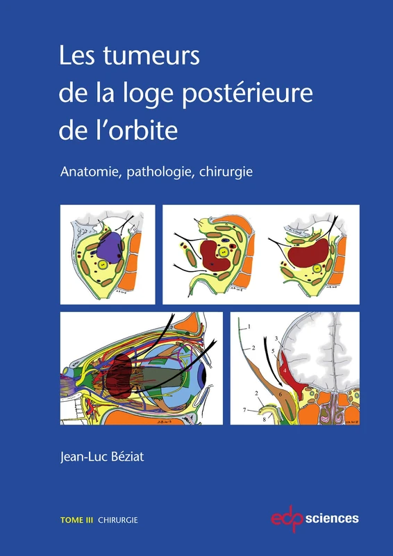 Les tumeurs de la loge postérieure de l'orbite - Tome 3: Tome 3 - Chirurgie: 0