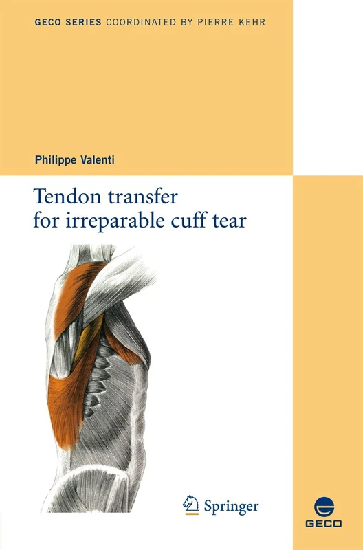 Tendon transfer for irreparable cuff tear (Collection GECO) - Image 1