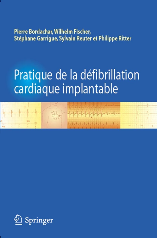 Pratique De La Defibrillation Cardiaque Implantable
