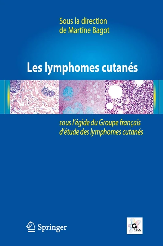 Les Lymphomes Cutanés: Sous L'égide Du Groupe Français D étude Des Lymphomes Cutanés