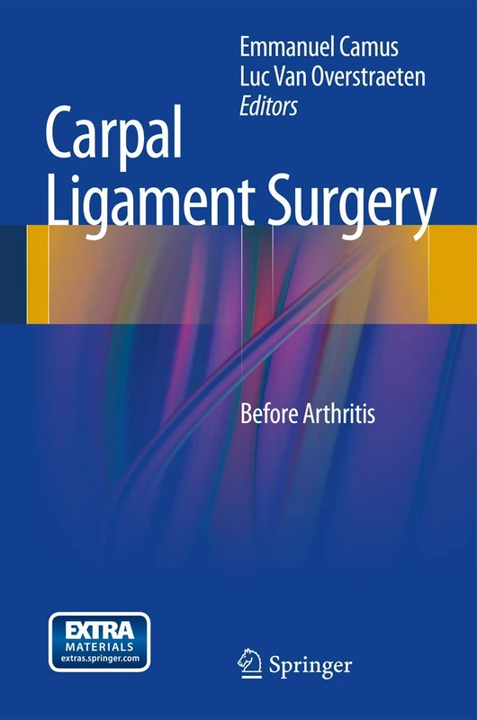 Carpal Ligament Surgery: Before Arthritis