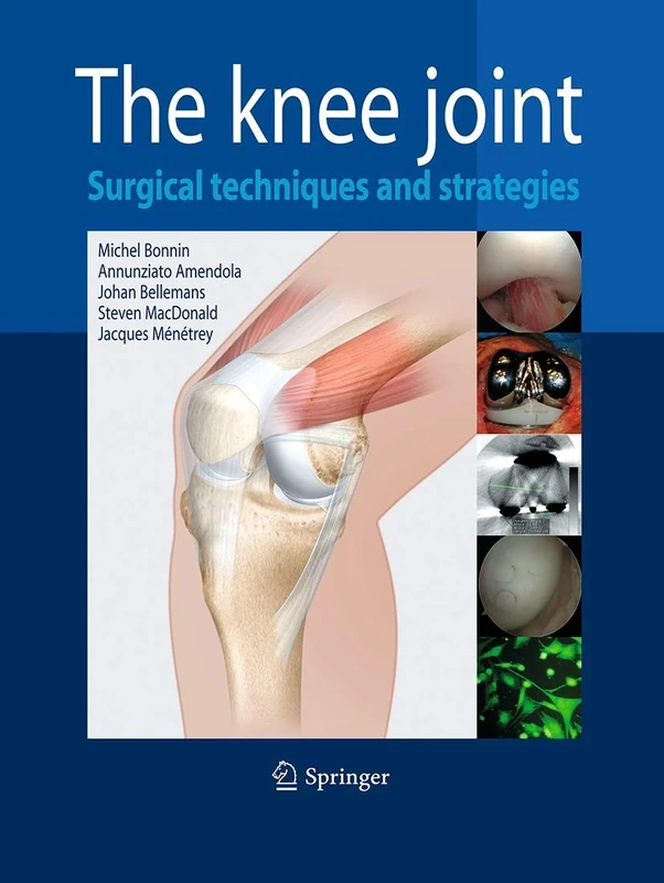 The Knee Joint: Surgical Techniques and Strategies