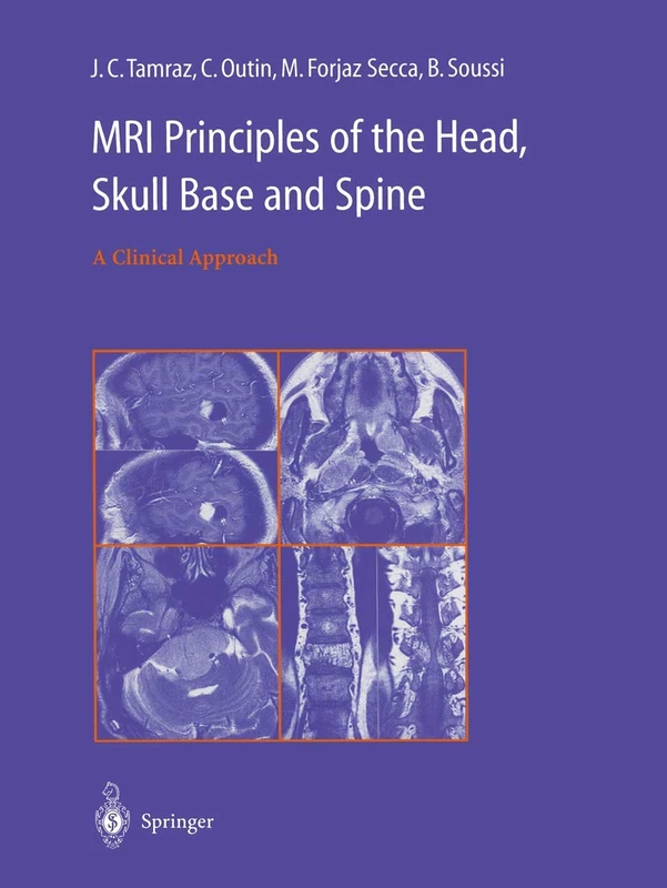 Springer MRI Principles of the Head, Skull Base and Spine