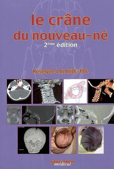 LE CRANE DU NOUVEAU NE 2E ED: Des contraintes foetales et leurs enjeux neurologiques aux répercussions chez l'adulte