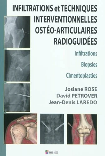 INFILTRATIONS ET TECHNIQUES INTERVENTIONNELLES OSTEO-ARTICULAIRES RADIOGUIDEES (0000): Infiltrations, Biopsies, Cimentoplasties