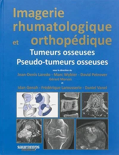 IMAGERIE RHUMATOLOGIQUE ET ORTHOPEDIQUE TOME 4 - TUMEURS OSSEUSES ET PSEUDO-TUME: Tome 4, Tumeurs osseuses ; Pseudo-tumeurs osseuses