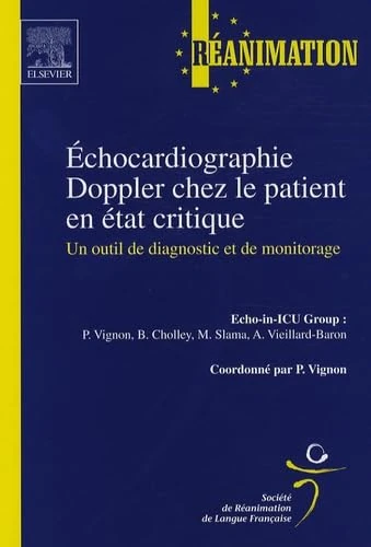 Échocardiographie Doppler chez le patient en état critique: Un outil de diagnostic et de monitorage