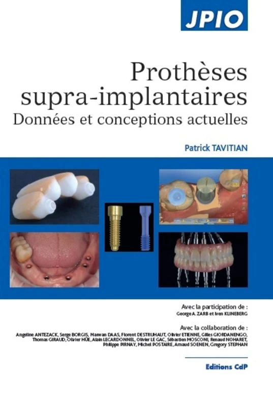 Prothèses supra-implantaires: Données et conceptions actuelles