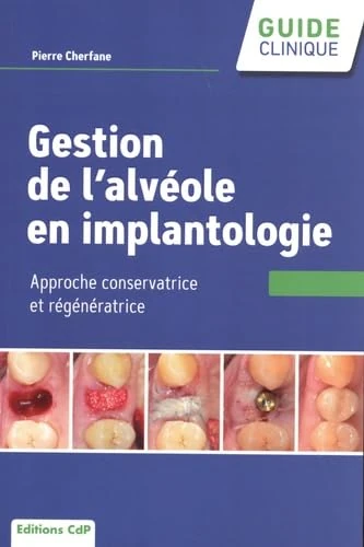 Gestion de l'alvéole en implantologie: Approche conservatrice et régénératrice