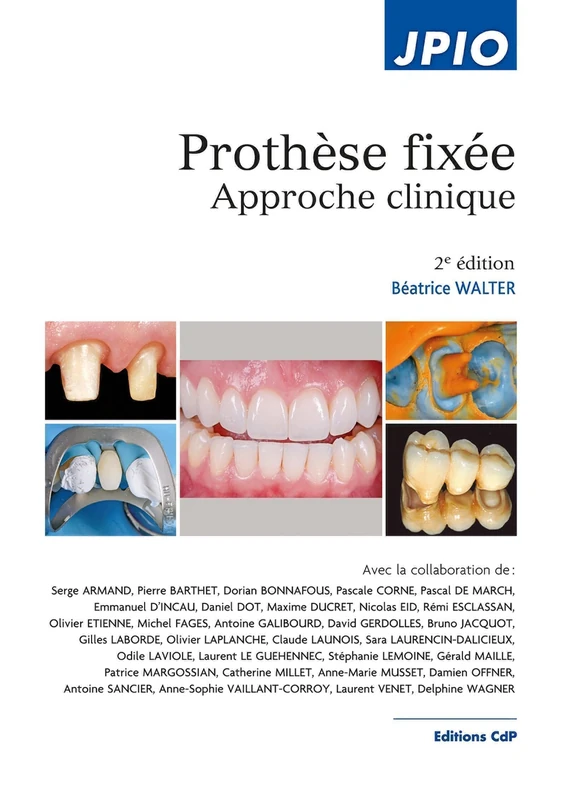 Prothèse fixée, 2e Ed.: Approche clinique