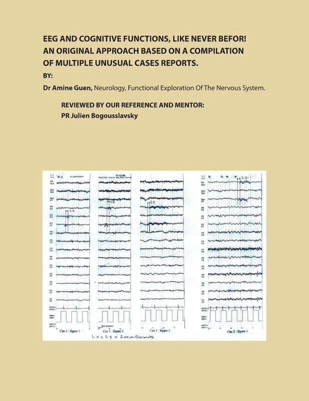 EEG AND COGNITIVE FUNCTIONS , LIKE NEVER BEFOR!: AN ORIGINAL APPROACH BASED ON A COMPILATION OF MULTIPLE UNUSUAL CASES REPORTS