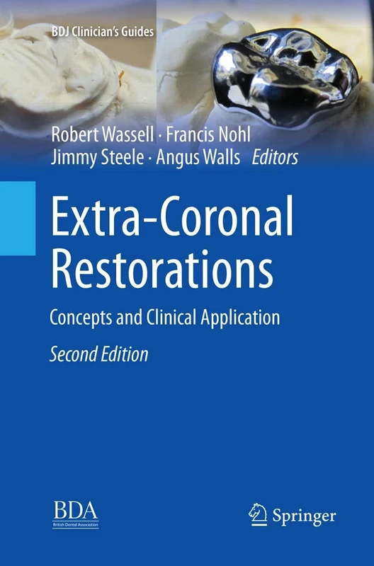 Extra-Coronal Restorations: Concepts and Clinical Application (BDJ Clinician’s Guides)