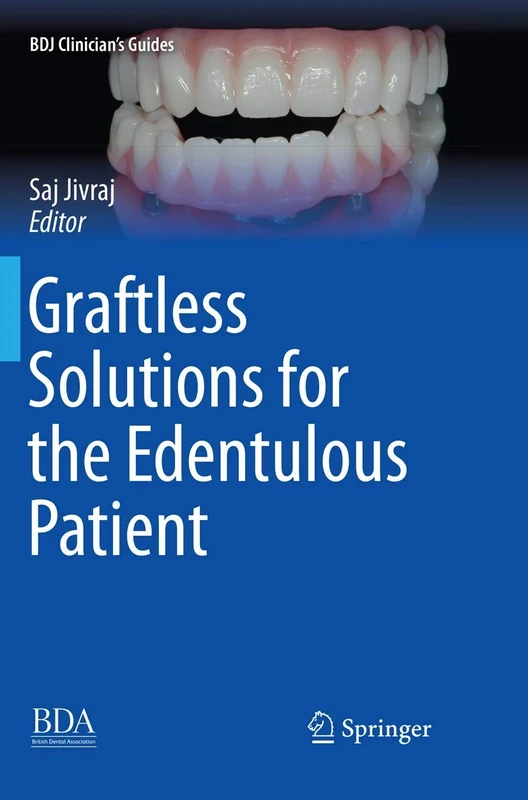 Graftless Solutions for the Edentulous Patient (BDJ Clinician’s Guides)