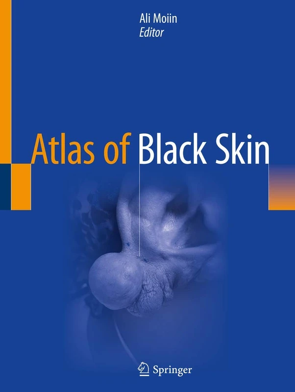 Springer Atlas of Black Skin - Dermatological Medical Reference