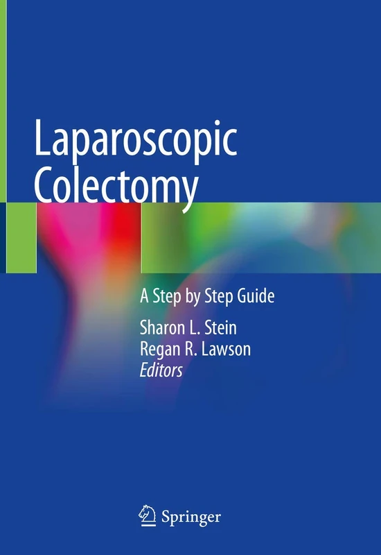 Laparoscopic Colectomy: A Step by Step Guide - Image 1