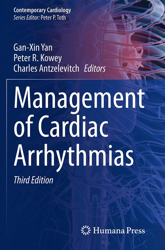 Management of Cardiac Arrhythmias (Contemporary Cardiology)