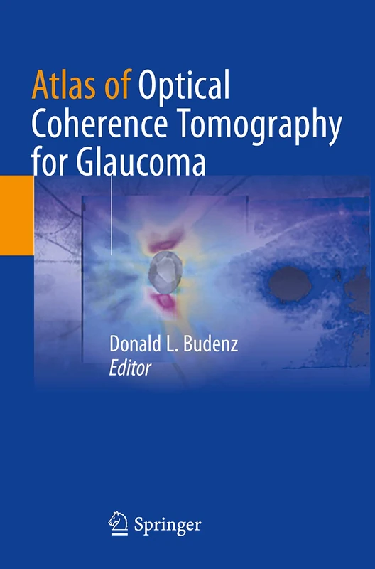 Springer Atlas of Optical Coherence Tomography for Glaucoma