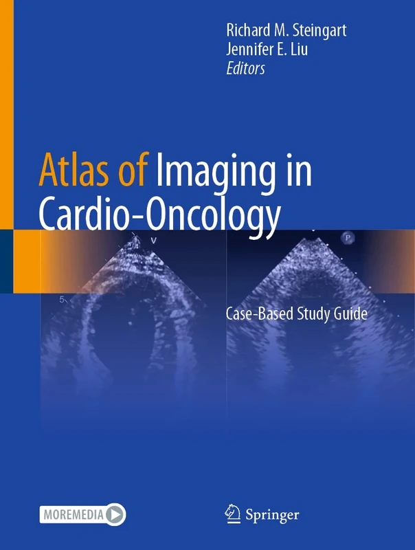 Atlas of Imaging in Cardio-Oncology: Case-Based Study Guide
