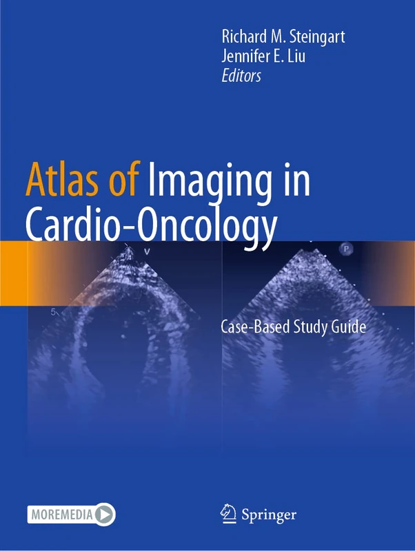 Atlas of Imaging in Cardio-Oncology: Case-Based Study Guide