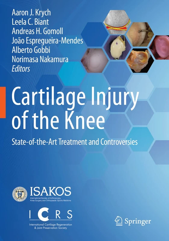 Cartilage Injury of the Knee: State-of-the-Art Treatment and Controversies