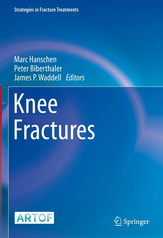 Knee Fractures (Strategies in Fracture Treatments)