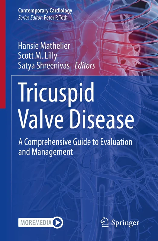 Tricuspid Valve Disease: A Comprehensive Guide to Evaluation and Management (Contemporary Cardiology)