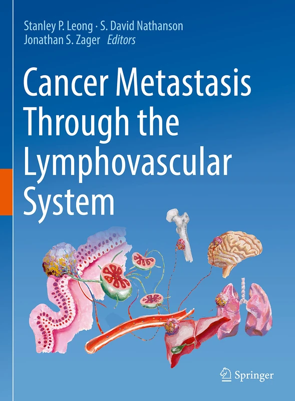Cancer Metastasis Through the Lymphovascular System: A Comprehensive Textbook