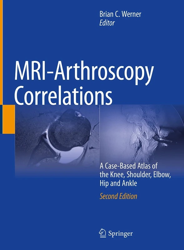 MRI-Arthroscopy Correlations: A Case-Based Atlas of the Knee, Shoulder, Elbow, Hip and Ankle