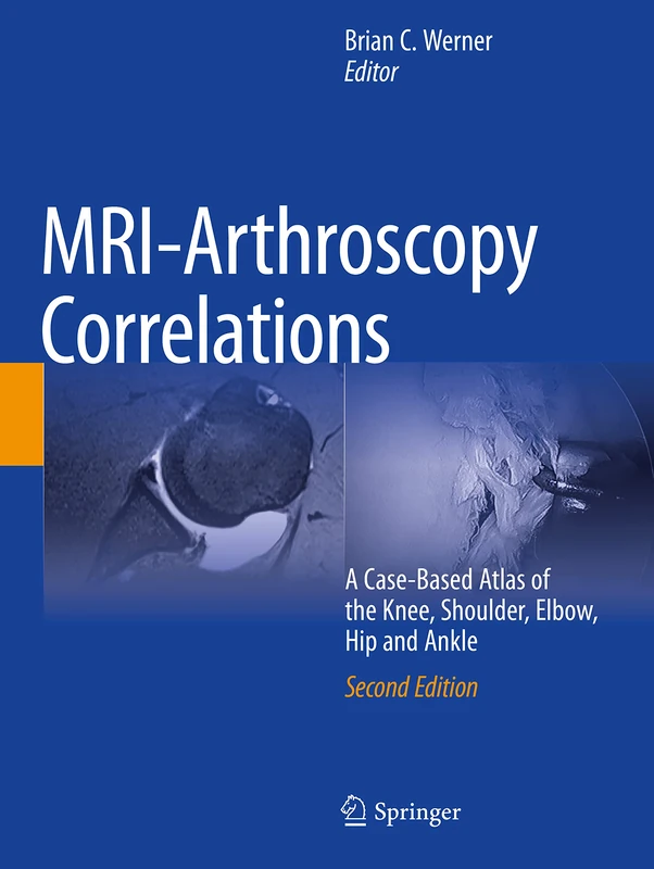 MRI-Arthroscopy Correlations: A Case-Based Atlas of the Knee, Shoulder, Elbow, Hip and Ankle