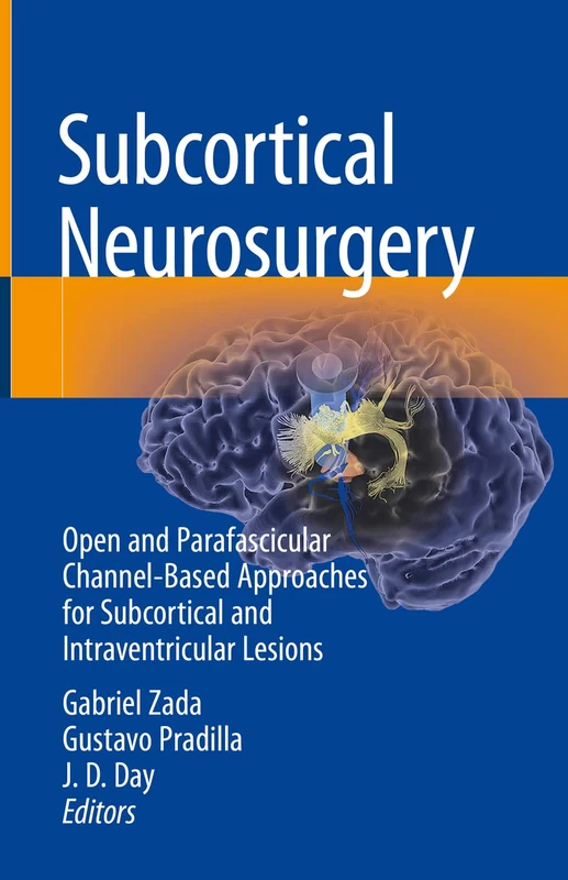 Subcortical Neurosurgery: Open and Parafascicular Channel-Based Approaches for Subcortical and Intraventricular Lesions