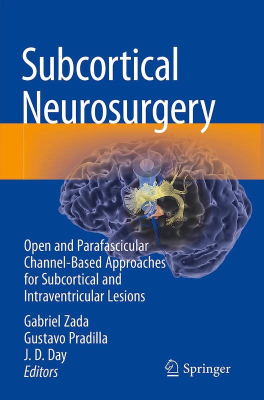 Subcortical Neurosurgery: Open and Parafascicular Channel-Based Approaches for Subcortical and Intraventricular Lesions - Image 1