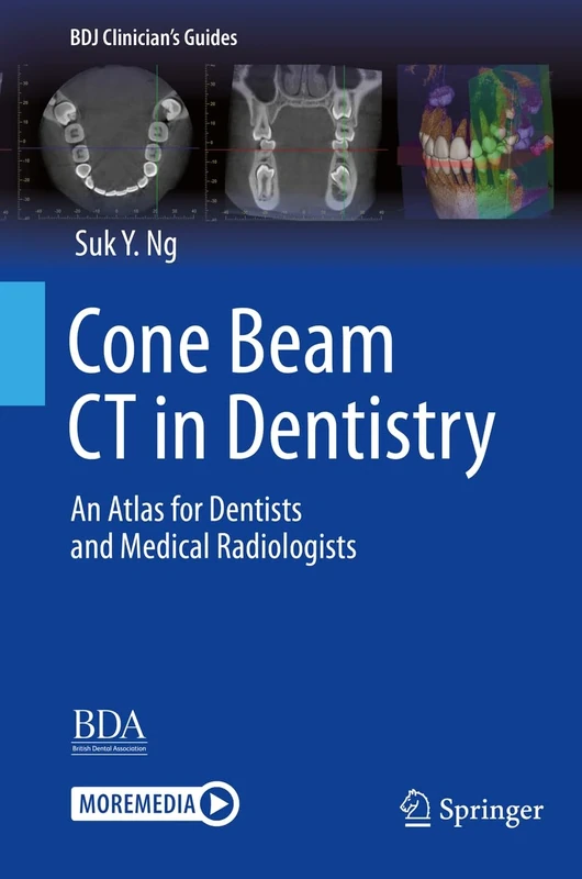 Cone Beam CT in Dentistry: An Atlas for Dentists and Medical Radiologists (BDJ Clinician’s Guides)