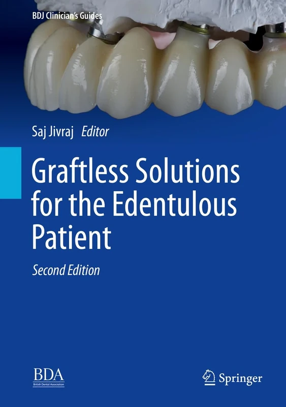 Graftless Solutions for the Edentulous Patient (BDJ Clinician’s Guides)