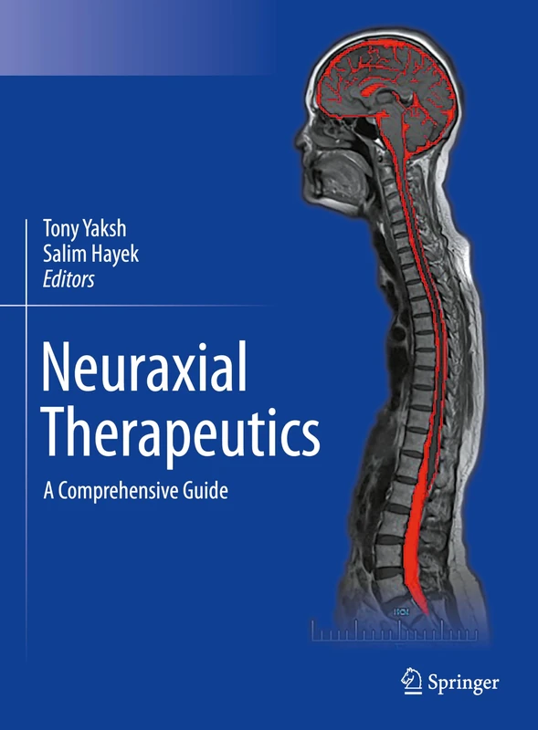 Neuraxial Therapeutics: A Comprehensive Guide