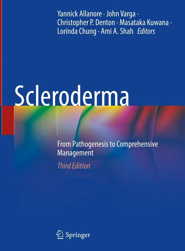 Scleroderma: From Pathogenesis to Comprehensive Management