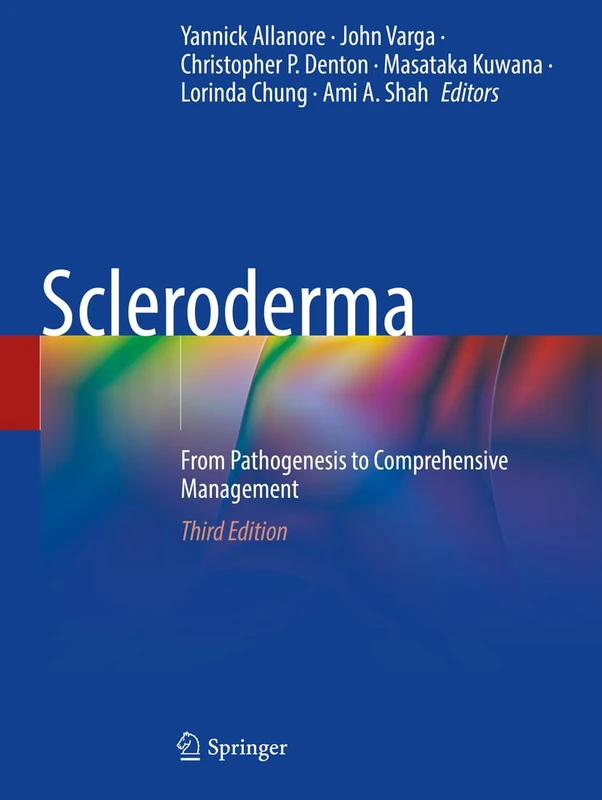 Scleroderma: From Pathogenesis to Comprehensive Management