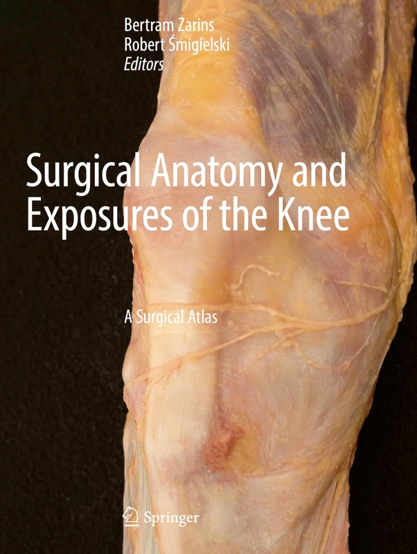 Surgical Anatomy and Exposures of the Knee: A Surgical Atlas